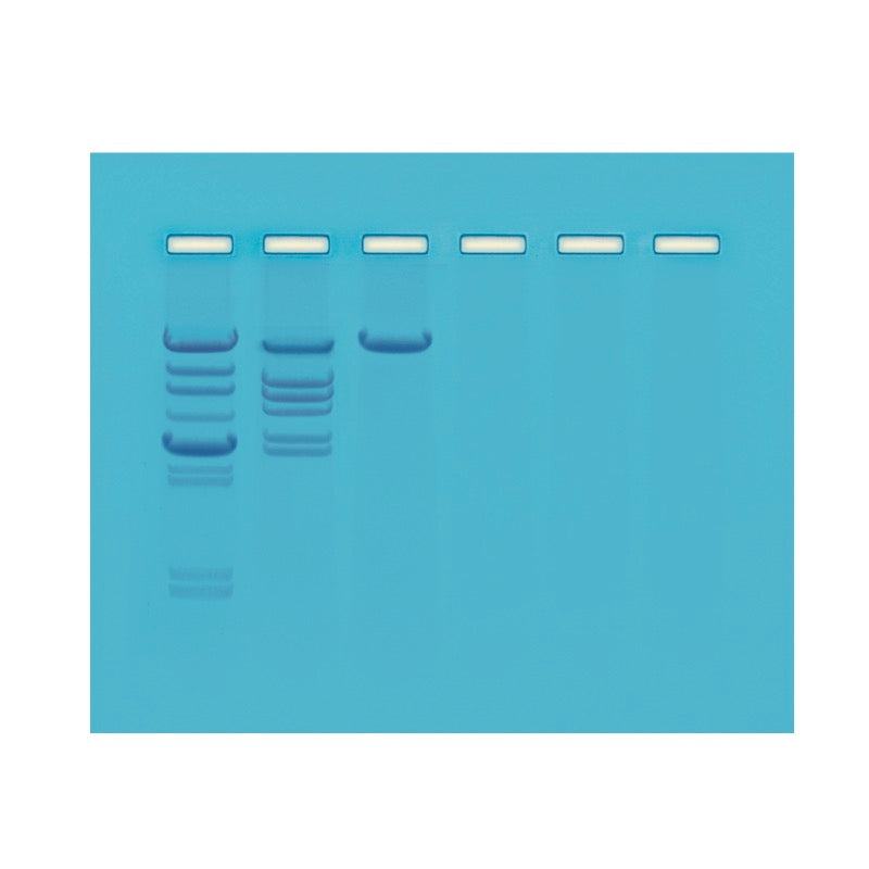 Biotechnology Restriction Enzyme Analysis of DNA Edvotek 112/AP09