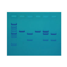 Load image into Gallery viewer, Edvotek 118 Cholesterol Diagnostics