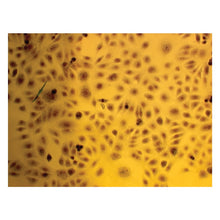 Load image into Gallery viewer, Edvotek 990 Morphology of Cancer Cells