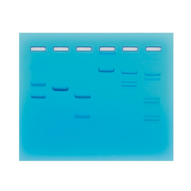 Edvotek 102 Restriction Enzyme Cleavage Patterns of DNA