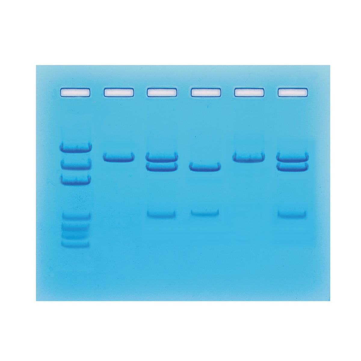 Nucleic Acid Testing for COVID19 Edvotek 123 Discovering DNA
