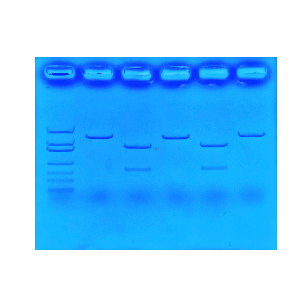 135 Using CRISPR To Treat Cystic Fibrosis gel