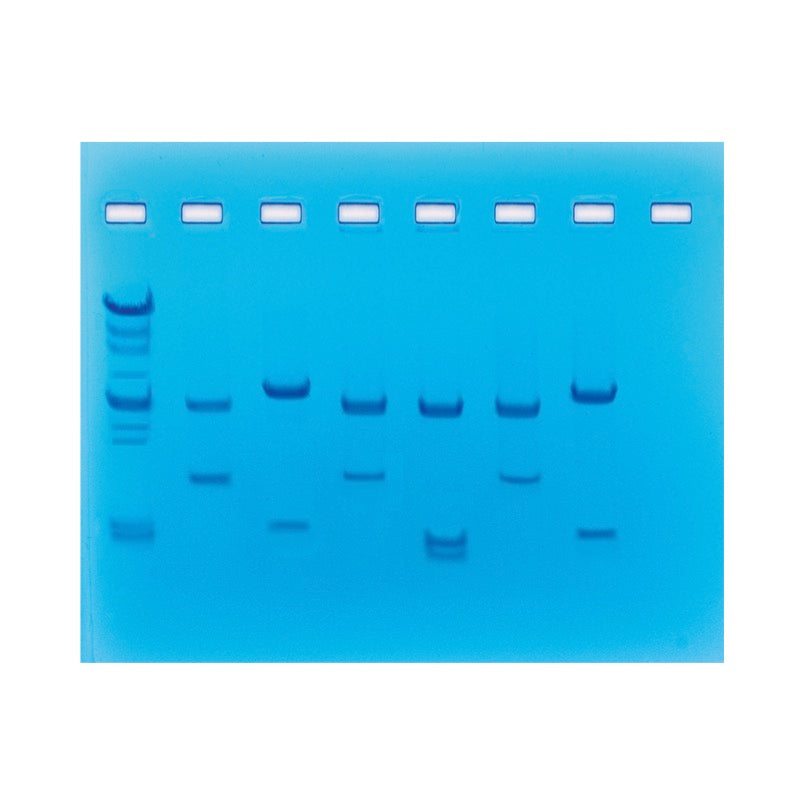 Edvotek 225 DNA Fingerprinting Using Restriction Enzymes