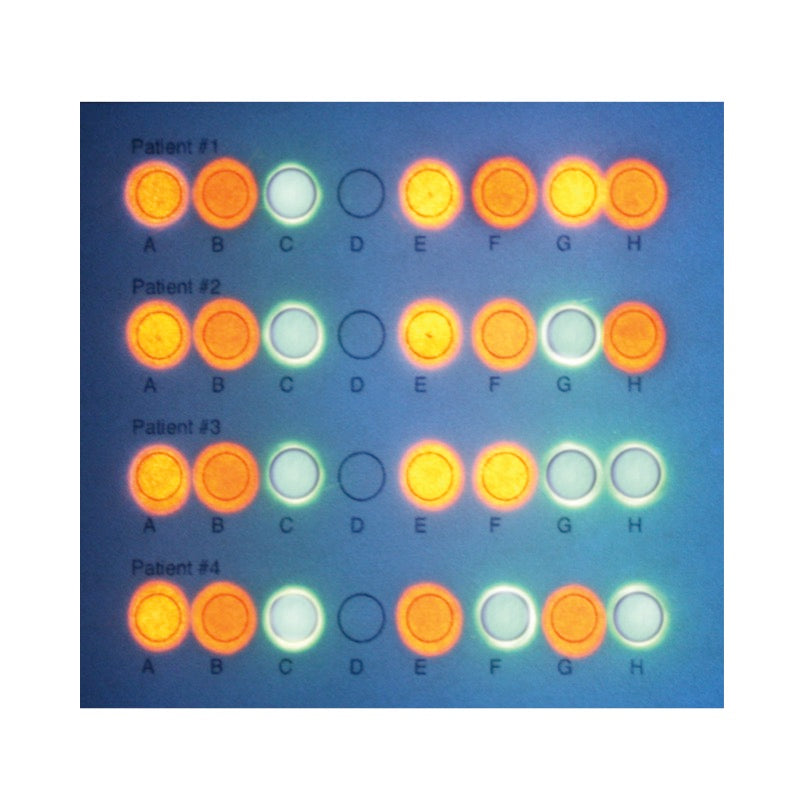 DNA Microarray Kit Edvotek 235 DNA/RNA Microarrays Kit - For 10 Student ...