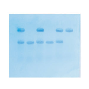 Edvotek 315 In Search of the Sickle Cell Gene by Southern Blot