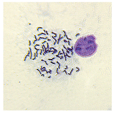 987 Chromosome Spread (Pre-Fixed Slides)